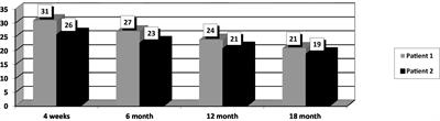 Case series: Cariprazine in early-onset schizophrenia